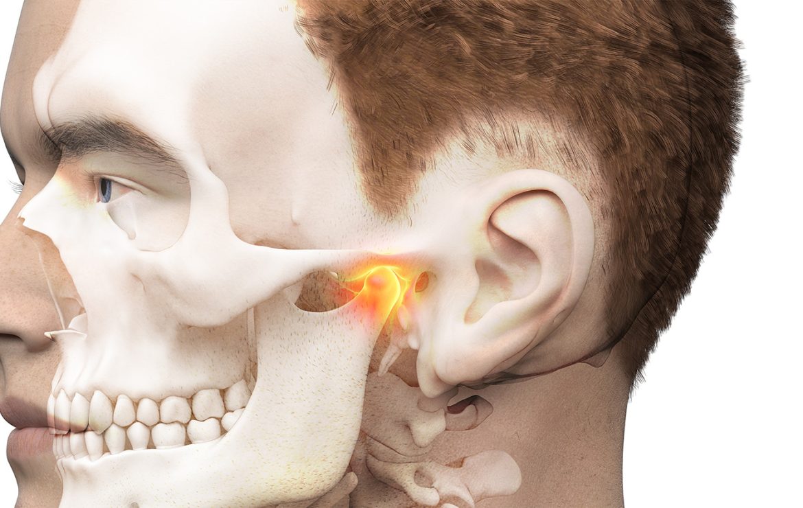 TMJ Disorder: Causes, Symptoms & The Best Treatment in Dubai