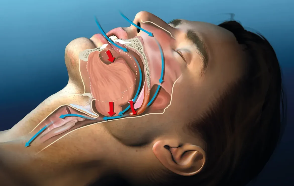 Airway Dentistry: A New Era of Healing