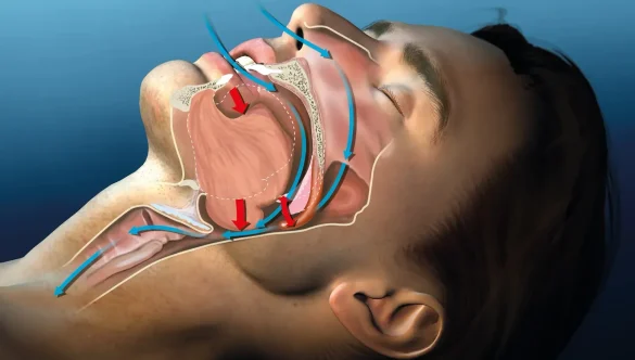 Airway Dentistry: A New Era of Healing