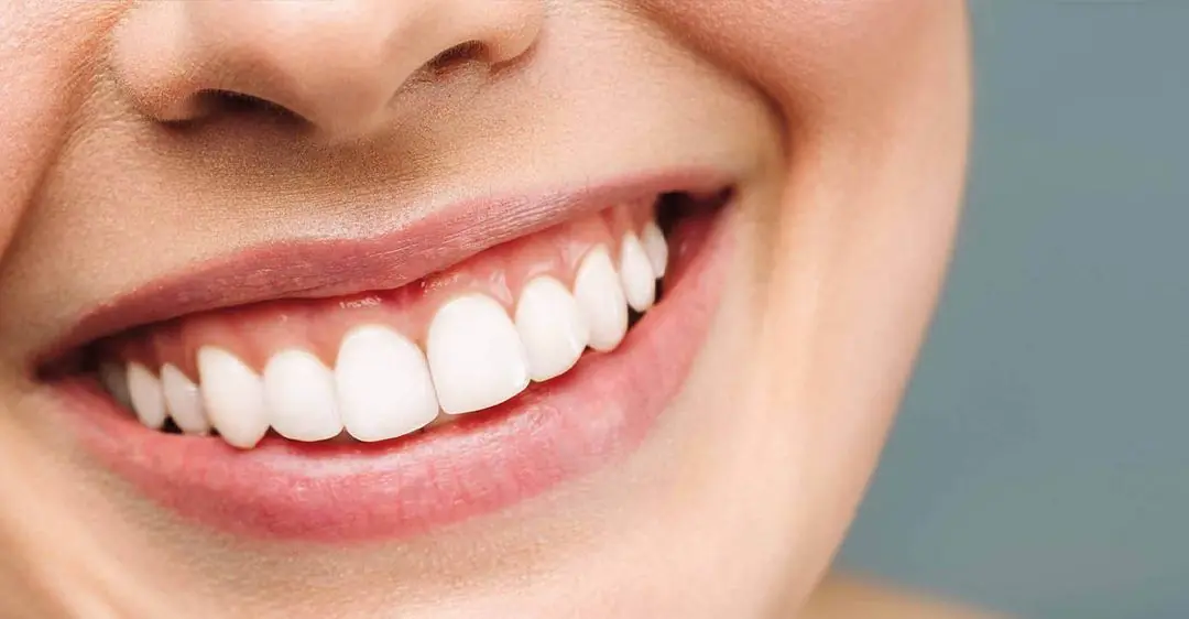 66ddd0e1fa9ffe6669354990_closeupsmile-p-1080