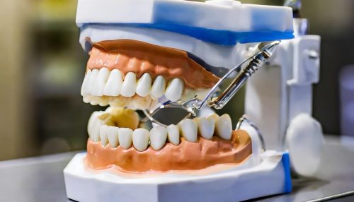 66ddea5ffa9ffe6669500725_modern-medical-science-model-teeth-isolated Large