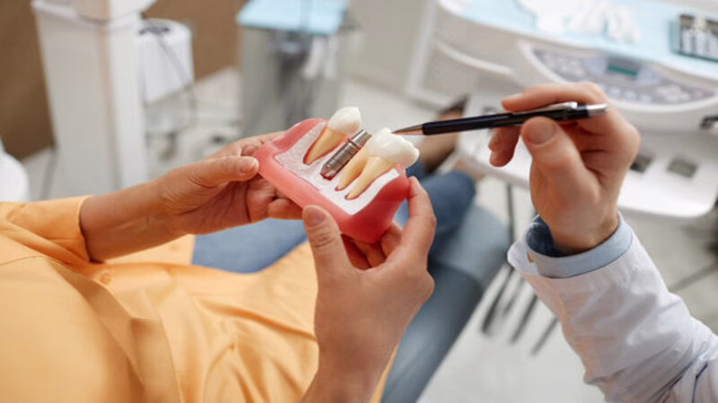 Are Dental Implants Painful? Myths vs. Facts